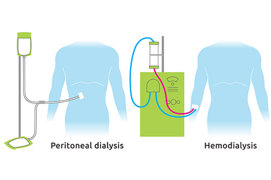 Knowing Dialysis Access Types